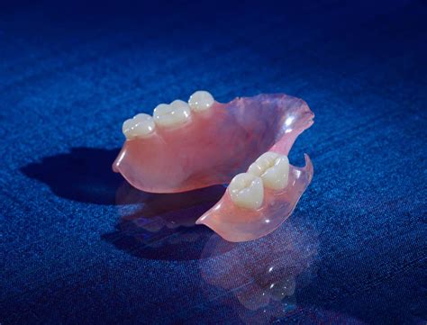 metal denture base fabrication|flexible partial dentures vs metal.